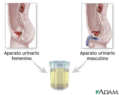 TP N º 6: Citología urinaria